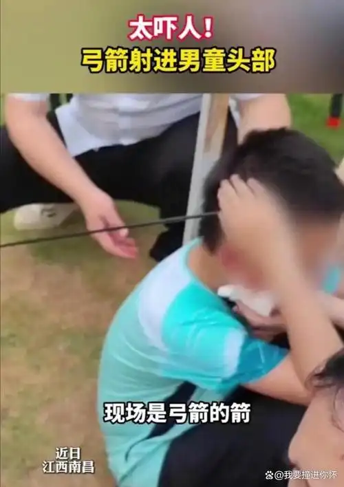 看台绝望！儿子被射手精准点杀，齐祖无奈摇头，KPL新版本射手成神